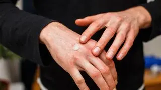 Jedna seria maści została wycofana ze sprzedaży