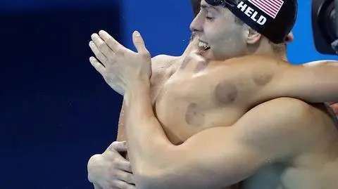 Plamy na ciele Phelpsa. Bańki na igrzyskach