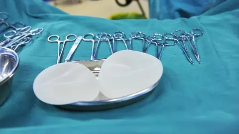 Francja zakaże implantów piersi. Ryzyko raka