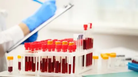 Nieprawidłowy poziom dobrego cholesterolu może zwiększać ryzyko demencji