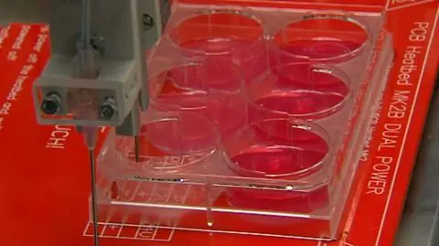 Skóra może w przyszłości posłużyć do przeszczepów