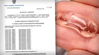 Główny Inspektor Farmaceutyczny wycofał ze sprzedaży żel Lignocainum Jelfa