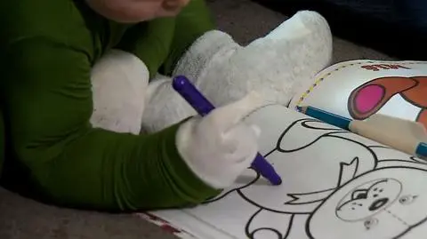 Plastry dla chorych na EB: producent obniży ceny opatrunków