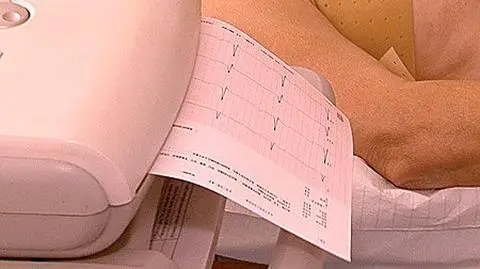 PZU Życie pozwane za załamek Q