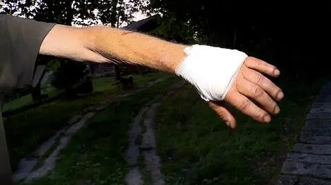 Twierdzi, że został pogryziony przez wilka