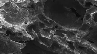 Zdjęcie pączka wykonane za pomocą skaningowego mikroskopu elektronowego 