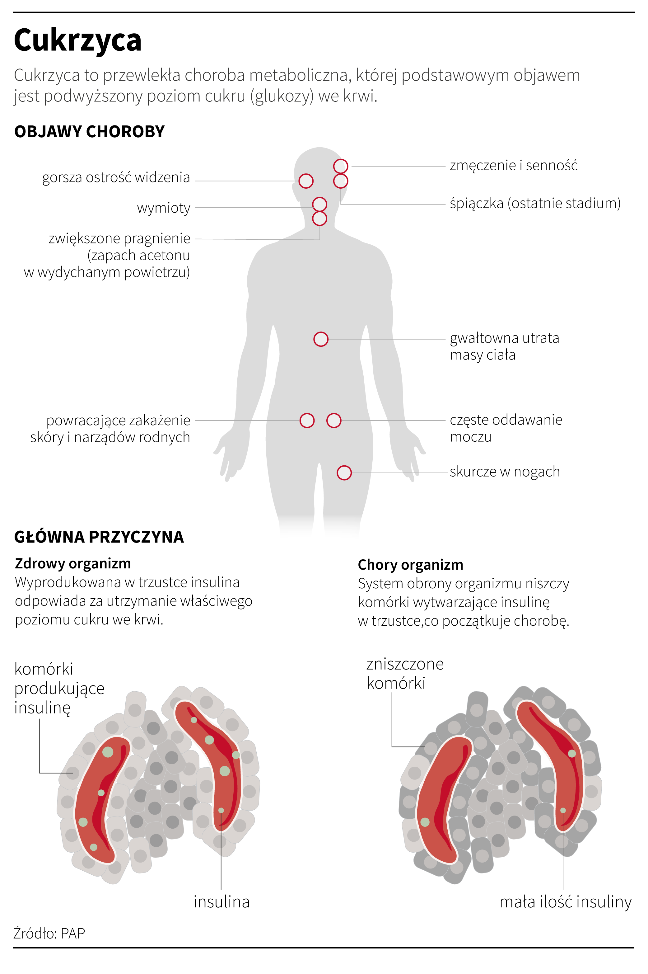 Cukrzyca. Na czym polega?