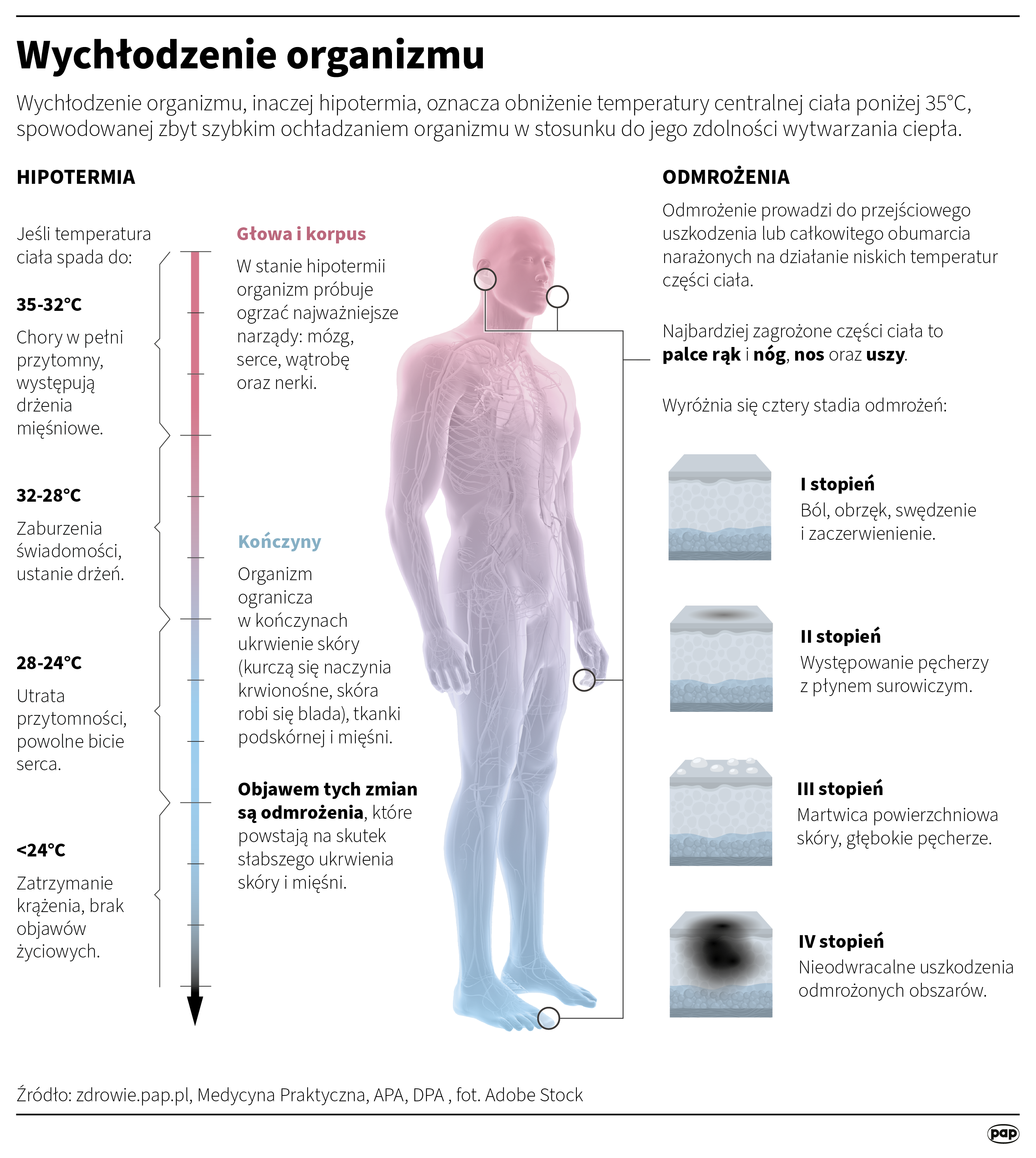 Wychłodzenie organizmu 