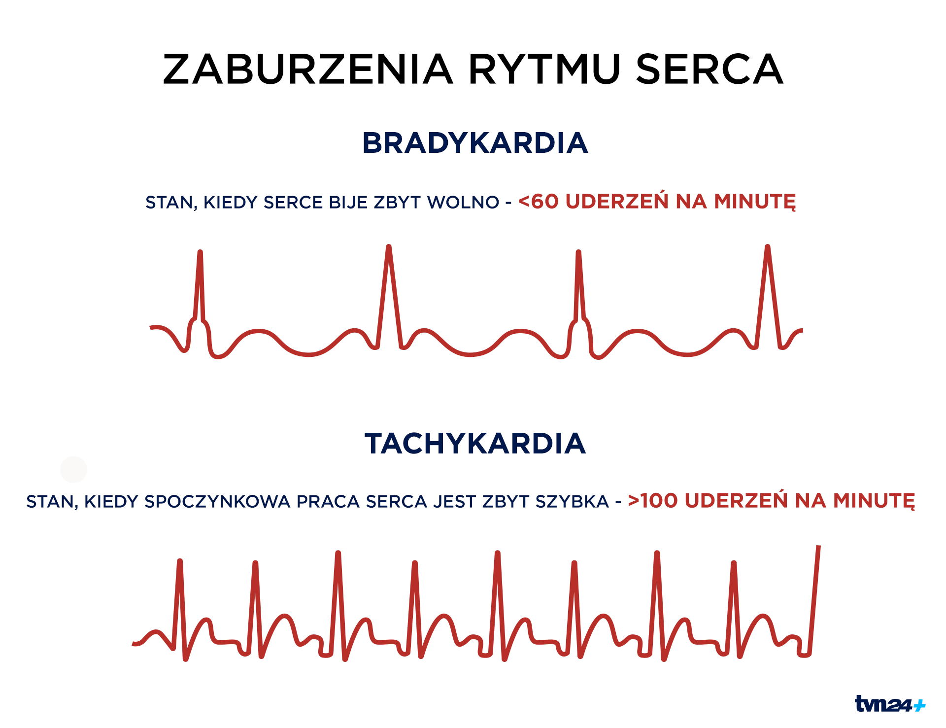 Zaburzenia rytmu serca