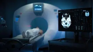 Aparat do MRI z wielką siłą wciągnął mężczyznę do środka. 