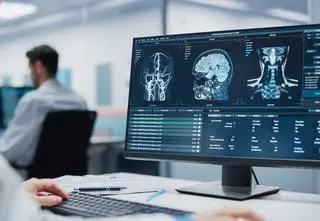 Od gabinetu do gabinetu z płytką i opisem. Radiolodzy: tak nie może być