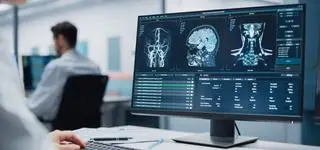 TIA czy udar? Krótki alarm, który może uratować życie