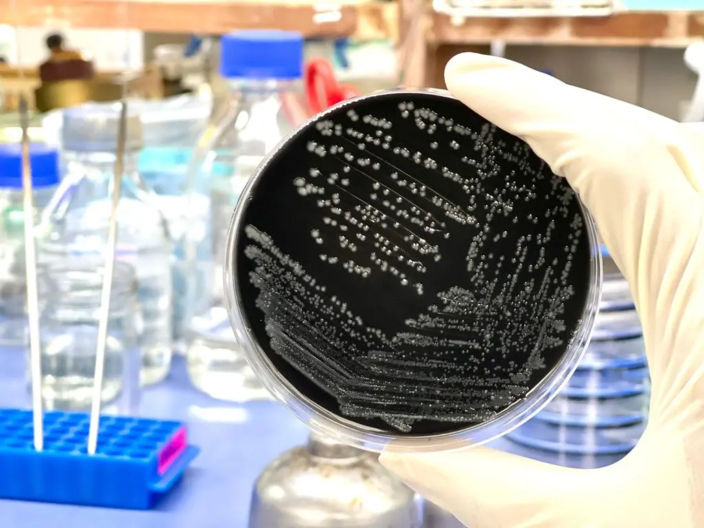Kolonie bakterii Campylobacter jejuni w laboratorium