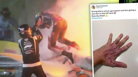 Problemy byłego kierowcy Formuły 1, przejdzie kolejny zabieg