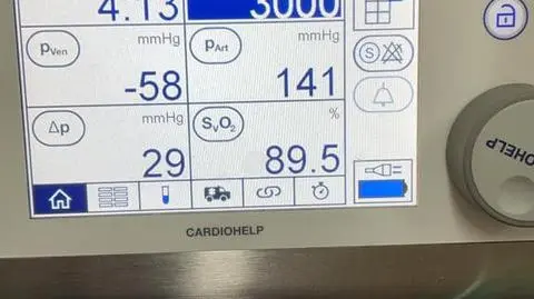 "Możemy mówić o cudzie". Lekarze uratowali życie ciężarnej z poważnym przebiegiem COVID-19