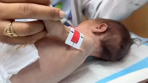 Trzymiesięczna dziewczynka w Strefie Gazy cierpi na niedożywienie