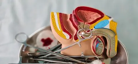 Rak prącia - rzadki, ale groźny. Jak uniknąć amputacji narządu?