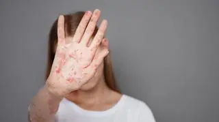 Ta choroba "resetuje" układ odpornościowy. Potwierdzone zakażenia na Podkarpaciu