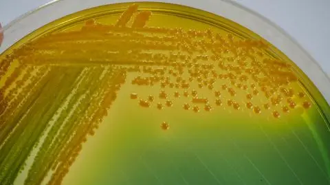 Vibrio cholerae 