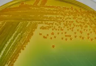 Cholera - na jakie objawy zwrócić uwagę?