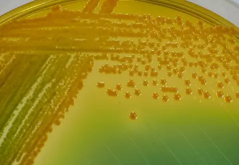 Cholera - na jakie objawy zwrócić uwagę?