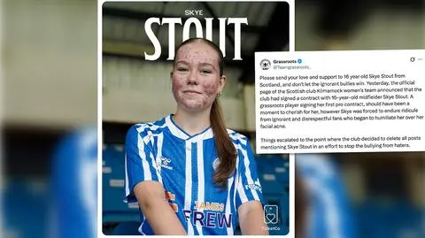 Młoda piłkarka podpisała zawodowy kontrakt. Zalał ją hejt. Powód? Trądzik