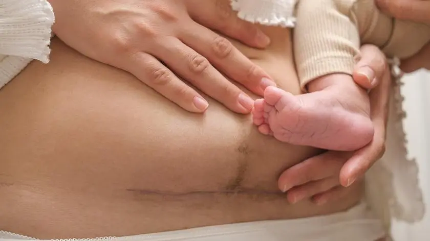 Cesarskie cięcie może prowadzić do zaburzeń snu? Naukowcy sprawdzili