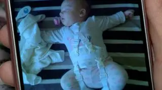 Dysplazja stawu biodrowego - dziecko w szelkach ortopedycznych