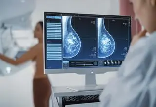 Kiedy USG, a kiedy mammografia? Samobadanie ważne, ale z rozwagą