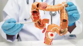 Prosta analiza zamiast kolonoskopii? "90 procent skuteczności w wykrywaniu raka"