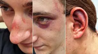 19-latek twierdzi, że został pobity przez policjantów 