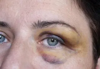 Kocha, lubi, szanuje. Bije, gwałci, morduje 