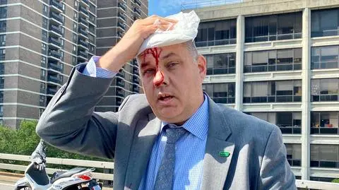 Szef nowojorskiej policji raniony na demonstracji. Burmistrz podpisał ustawę o reformie służby