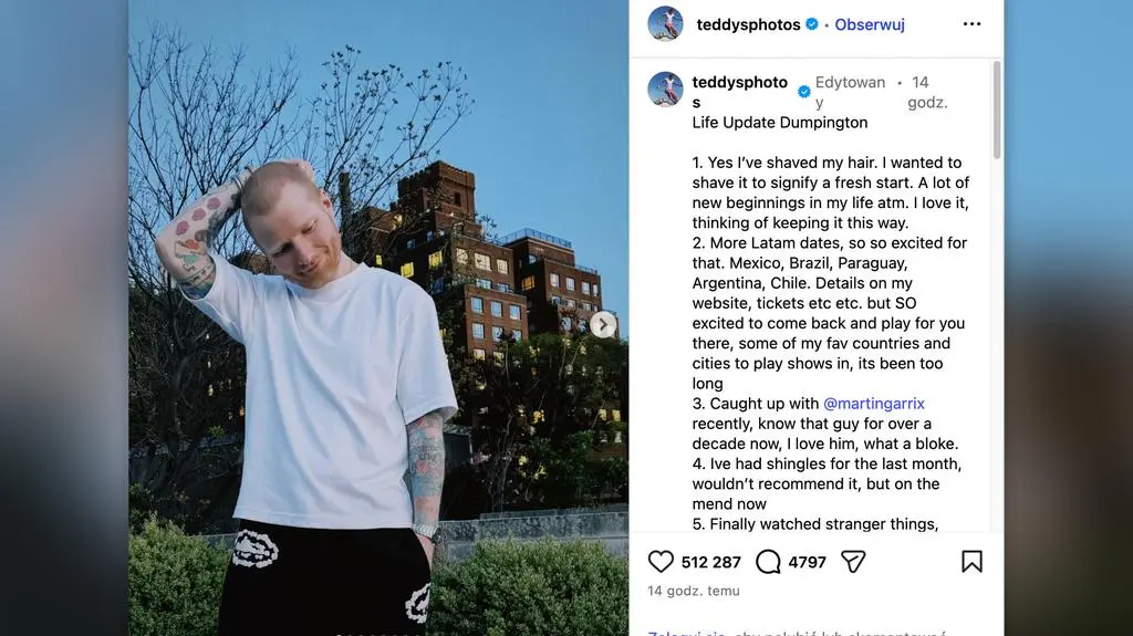 "Tak, ogoliłem głowę" - potwierdza Ed Sheeran. Niedawno nagrał utwór z Łatwogangiem