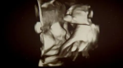 20 tysięcy za ciążę. Ile Polki płacą za gwarantowane świadczenia