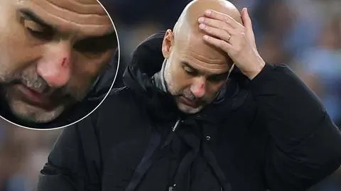 Krew na nosie i zadrapania na czole. Guardiola wyjaśnia