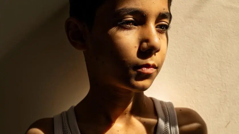 Oto zdjęcia roku. Znamy laureatów nagrody World Press Photo