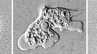 Naegleria fowleri może spowodować śmierć