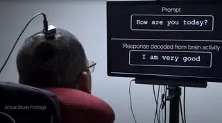 Amerykańscy neurochirurdzy w przełomowym badaniu wykorzystali fale mózgowe sparaliżowanego pacjenta