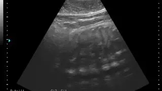 Sprzęt USG pomaga też w codziennej opiece nad fokami