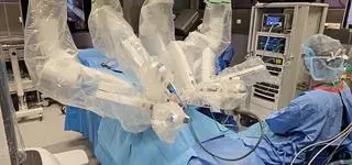 Roboty chirurgiczne są lepsze i dla chirurga, i dla pacjenta. Ale drogie