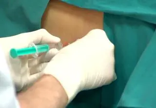 Porody ze znieczuleniem. Jest postęp, ale...