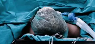 Śmiertelna pomyłka przy "prostym" zabiegu. Lekarz: nie jesteśmy serwisantami