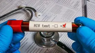 Ważne odkrycie dotyczące HIV. Dożywotnia terapia nie będzie już potrzebna?