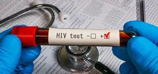 Przełom w badaniach nad HIV. Przeszczep komórek macierzystych pokonał wirusa