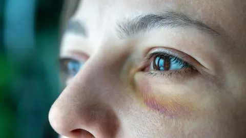 Każdego roku w Polsce z powodu przemocy domowej ginie około pół tysiąca kobiet 