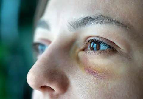 Dziesiątki tysięcy Niebieskich Kart to "czubek góry lodowej"