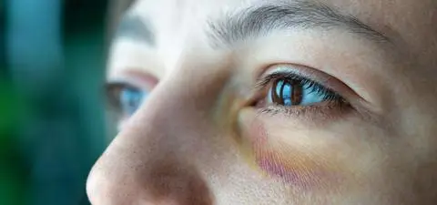 Dziesiątki tysięcy Niebieskich Kart to "czubek góry lodowej"