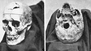 Czaszka Phineasa Gage'a trafiła do zbiorów uczelnianych