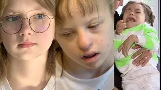 Szpital nie ma tomografu, troje dzieci cierpi